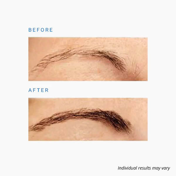 neuBROW before and after image on model
